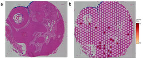 Skin flora as the key to cancer therapy?