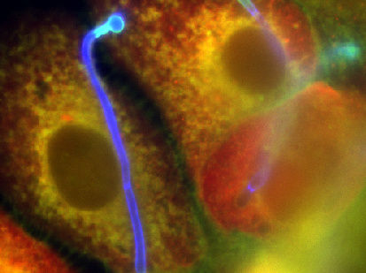 Leibniz-Institut für Naturstoff-Forschung und Infektionsbiologie