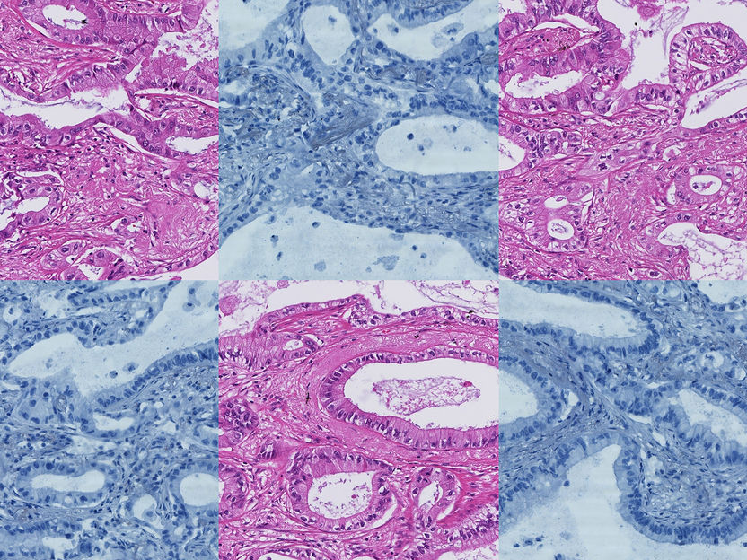 Modèle de base efficace en termes de données pour la détection de biomarqueurs - Intelligence artificielle pour la pathologie clinique : une nouvelle approche multitâche