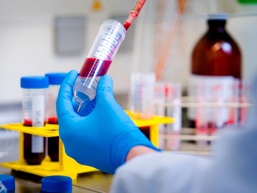 Autoimmunität: Immunzellen entgehen Therapie durch ruhenden Zustand - Einem Forschungsteam ist es gelungen, krankheitsverursachende T-Zellen bei Autoimmunerkrankungen aus dem Blut zu isolieren und zu analysieren