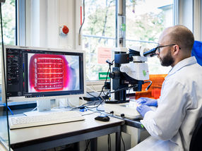 La bio-impression abordable : des tissus en un clic