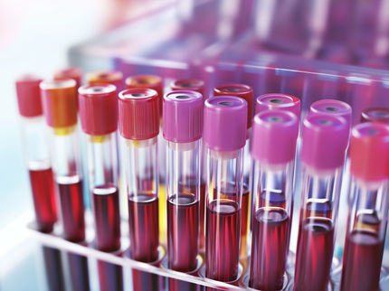 Blood Testing for so-called MicroRNAs Can Detect Dementia