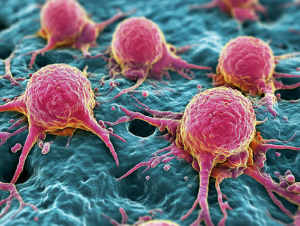 Pulmonary carcinoids:Mortal or immortal cancer cells?