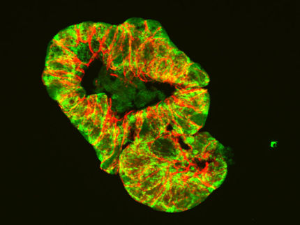 Möglicher Auslöser von Morbus Crohn entdeckt