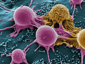 Un champignon pour la thérapie du cancer colorectal