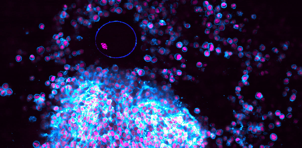 © Christopher Thomas, Tabea Lilian Marx et al. / Max Planck Institute for Multidisciplinary Sciences 