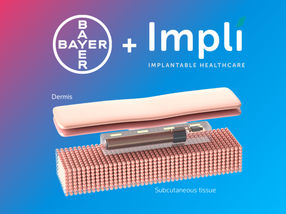 Bayer se asocia con una innovadora empresa de dispositivos de control hormonal