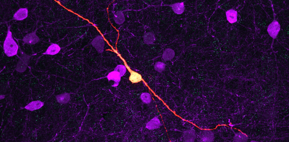 Possible approach for the treatment of neurological and neuropsychiatric diseases discovered