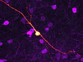 Possible approach for the treatment of neurological and neuropsychiatric diseases discovered