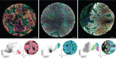 New imaging analysis method revolutionizes the diagnosis of head and neck tumors