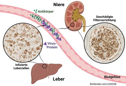 Why liver inflammation can damage the kidneys