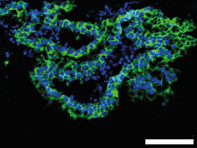 Markers in iPSC quality control – a new approach to enhance standardization