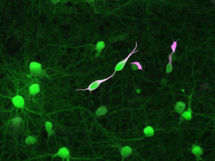 Las células tumorales cerebrales se integran rápidamente en los circuitos neuronales de todo el cerebro