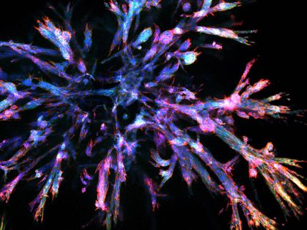 Les organoïdes représentent le paysage cellulaire complexe du cancer du pancréas