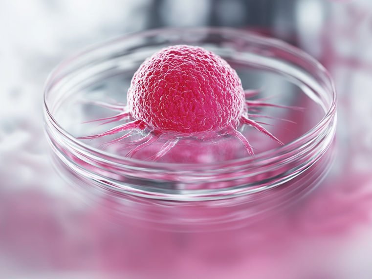 Scoperta: per la prima volta mini tumori coltivati da cellule tumorali circolanti - Nuovi approcci contro la metastatizzazione del cancro al seno