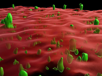 Membrane Anchor Suppresses Protein Aggregation