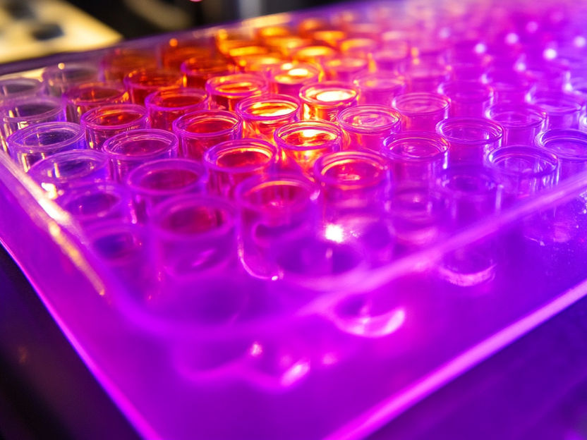 Testing the effect of thousands of compounds on cellular metabolism - New applications for tried and tested medications