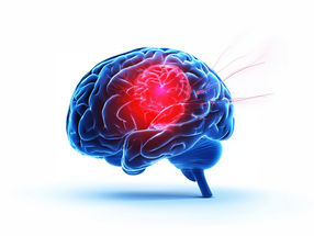 New perspectives for personalized therapy of brain tumors