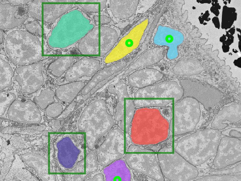 The underlying image from data published in Cell (S0092-8674(21)00876-X). Image created by Anwai Archit using the μSAM tool.
