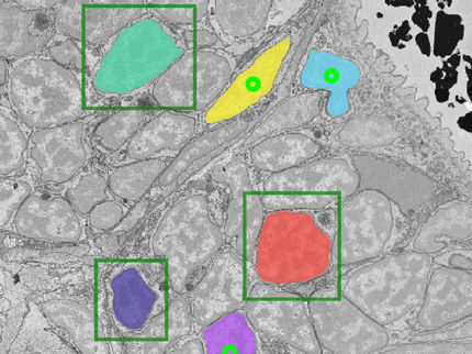 Analyse cellulaire automatisée grâce à l'intelligence artificielle
