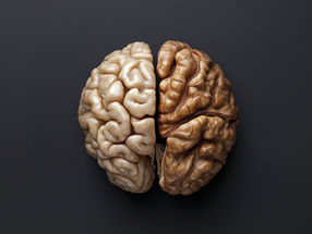 Eating walnuts for breakfast may boost your brain function