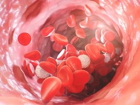 Rare side effect discovered in cancer immunotherapy