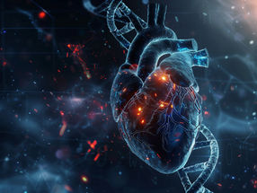 Descubren que la pérdida del cromosoma Y es un nuevo factor de riesgo de cardiopatías