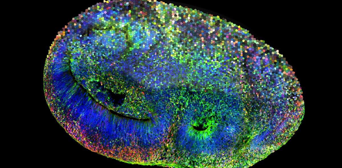 Construir mejores organoides cerebrales: un nuevo marco para los investigadores