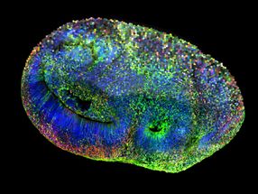 Building better brain organoids: A new framework for researchers