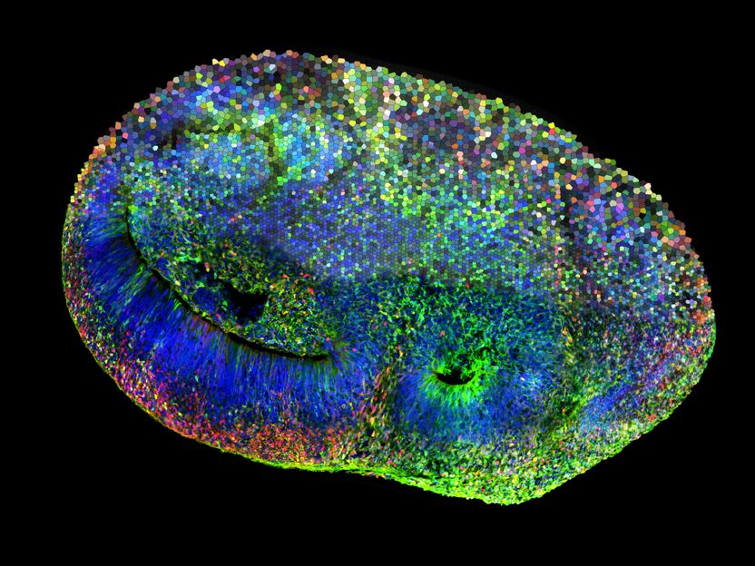 Organoidi cerebrali migliori: un nuovo quadro di riferimento per la ricerca - "Gli organoidi cerebrali cambieranno radicalmente la nostra comprensione dello sviluppo umano, dell'evoluzione e delle malattie e ci forniranno conoscenze che non potremmo ottenere altrimenti"