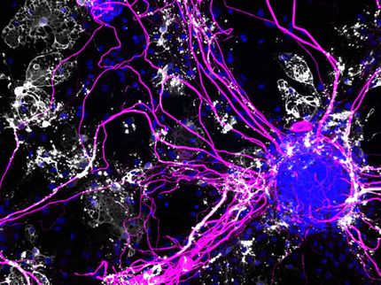 Un messager inflammatoire alimente la maladie d'Alzheimer