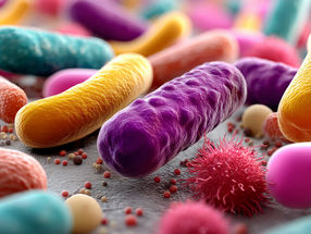 Gut microbiome as a predictive factor for kidney rejection?