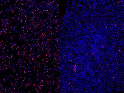 ARN antisens pour le traitement de l'épilepsie la plus sévère chez un enfant prématuré