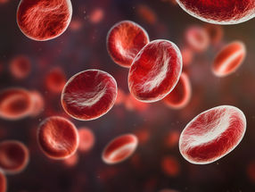 Heidelberg start-up develops system for precise drug monitoring with just one drop of blood
