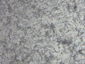 3D bioprinting: improved nutrient transport in printed tissue