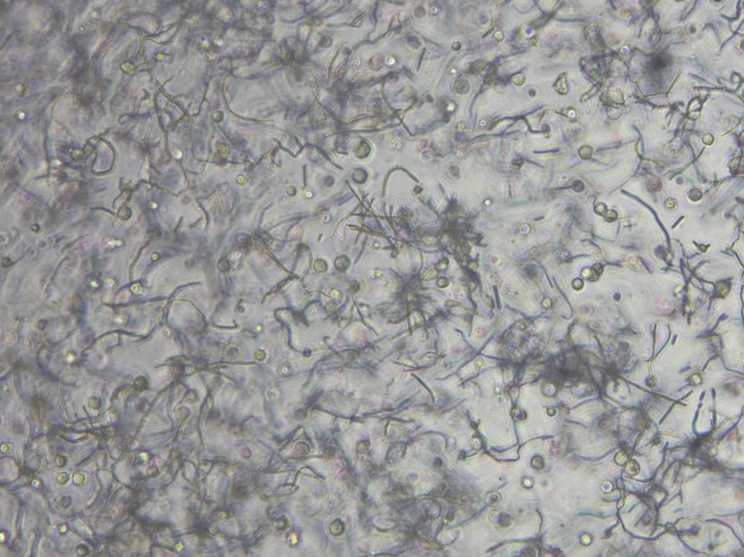 Bioimpresión 3D: mejora del transporte de nutrientes en el tejido impreso - NMI, TU Darmstadt y Black Drop desarrollan una biotinta mejorada
