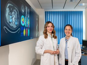 AI-based image analysis detects early organ damage