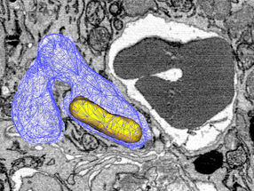 Survival trick: Pathogen taps iron source in immune cells