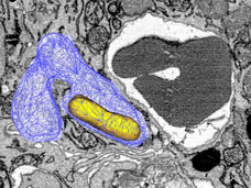 Survival trick: Pathogen taps iron source in immune cells