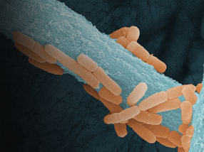 When fungi take your breath - How a mold can unbalance the lungs