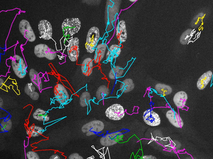 Live verfolgt: Wie Stress Krebszellen über Generationen verändert
