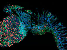 Empêcher l'inflammation chronique de se transformer en cancer