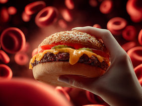 Les empreintes chimiques révèlent la consommation de fast-food