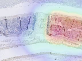 Wie sich Immunzellen im Körper verfolgen lassen
