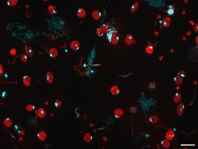 Una nuova scoperta potrebbe far progredire la lotta contro la malaria