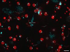 Una nuova scoperta potrebbe far progredire la lotta contro la malaria
