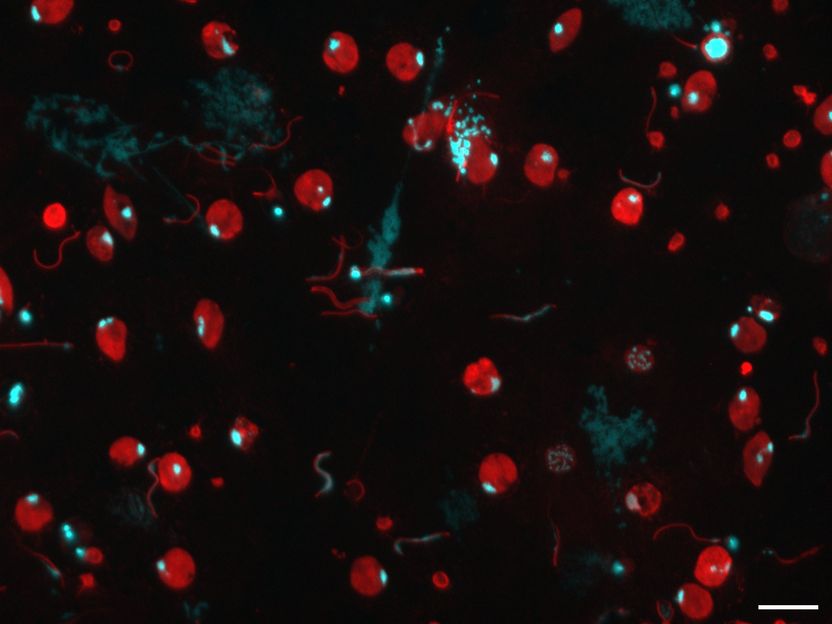 Neue Entdeckung könnte Malaria-Bekämpfung voranbringen - Schlüsselproteine für Malaria-Vermehrung in der Mücke gefunden