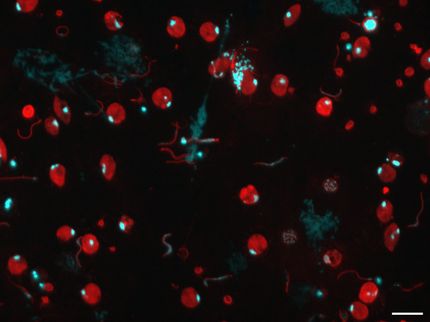 Una nuova scoperta potrebbe far progredire la lotta contro la malaria