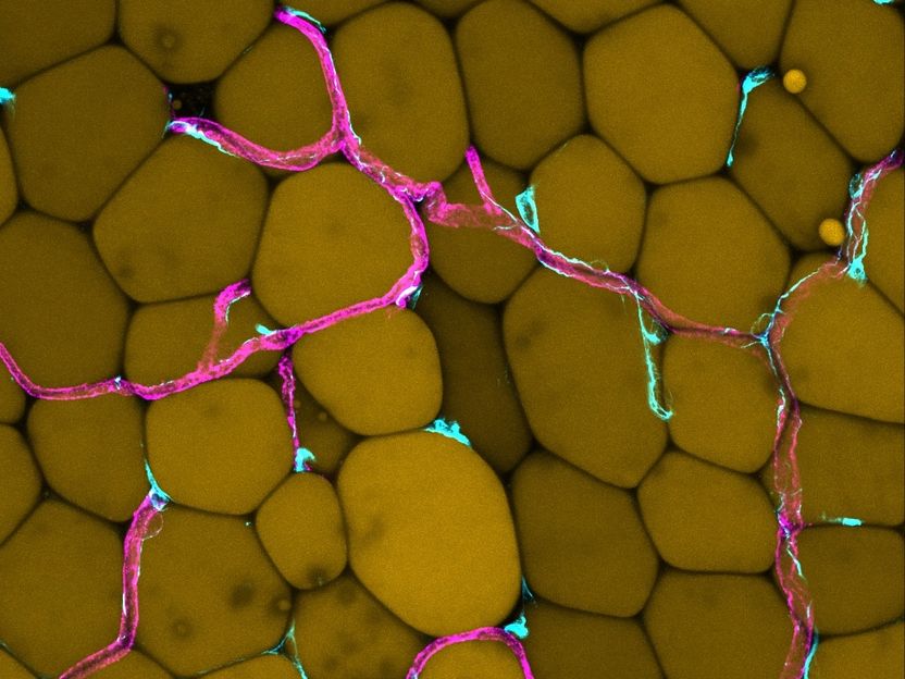 Copyright: Andreas Fischer & Sana Hasan, University Medical Centre Göttingen