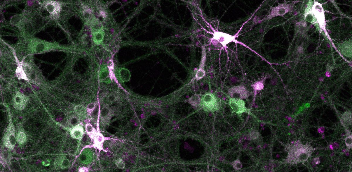 Indagine sull'attività delle chinasi nelle cellule viventi: gli scienziati costruiscono uno strumento di registrazione molecolare